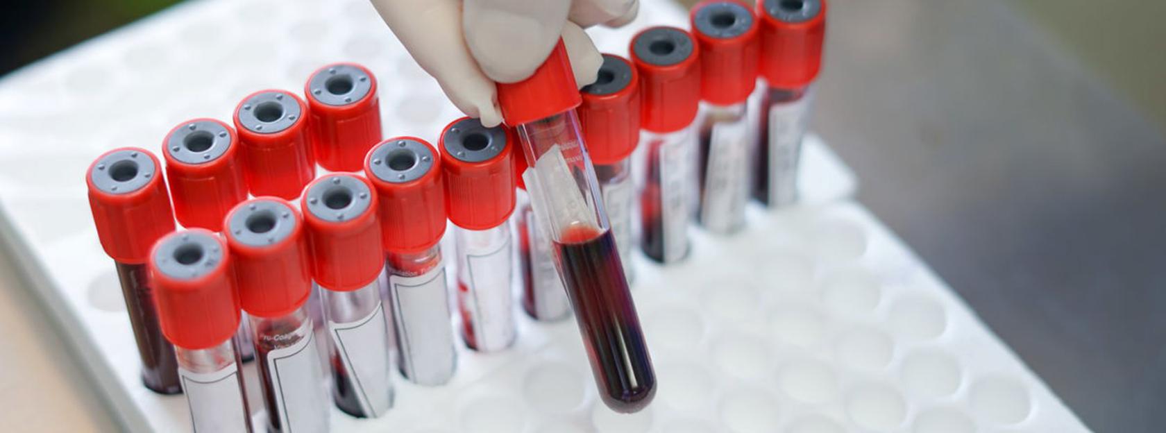 Specijalistička usluga vađenja krvi